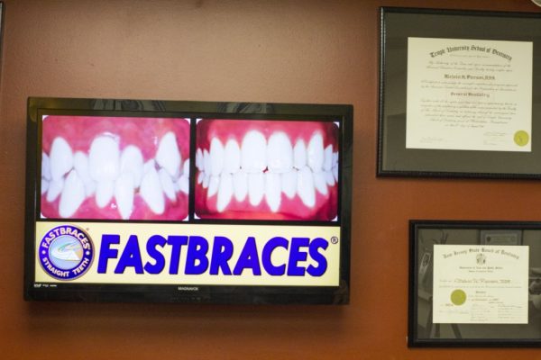 Pierson Dental Sicklerville NJ fast braces