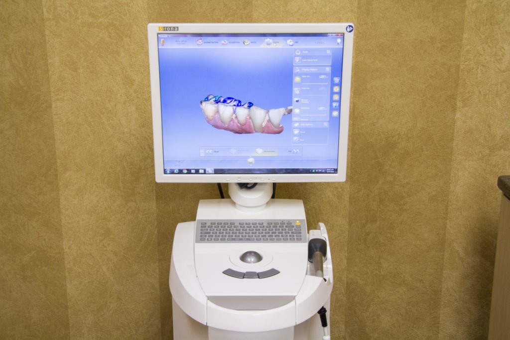 Long Grove Dental Studio Lake Zurich IL cgi teeth model